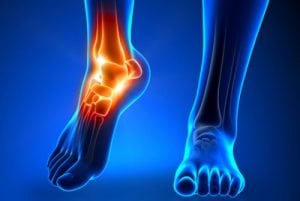 Arthroscopic Ankle Synovectomy