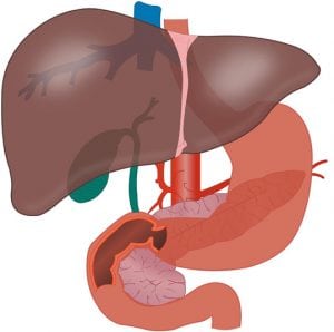 Laparoscopic Wedge Resection of the Liver