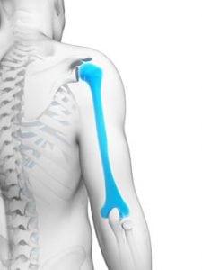 Open Reduction and Internal Fixation of the Proximal Humerus