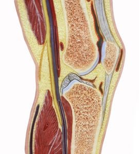 Arthroscopic Knee Synovectomy