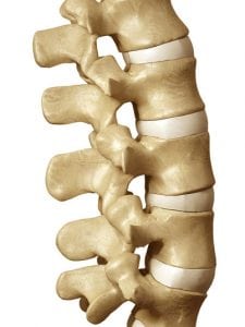 Back and Neck Surgery – Spinal Fusion