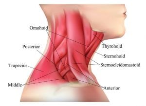 Complete Sternocleidomastoid Resection