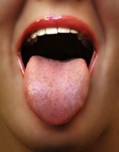 Tongue Surgery
